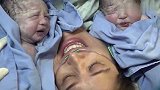 孕妈剖腹产下胖胖双胞胎，两个娃和妈妈脸贴脸，这小表情太可爱了