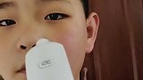 男孩发烧，两边脸温度截然不同