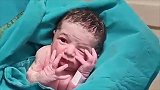 刚出生的小宝宝用手捂着自己半边脸，眼珠子转来转去的萌翻了！