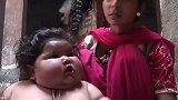 印度最胖女婴8个月重达40公斤  成真人版“米其林小胖人”