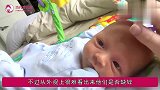 宝宝这3种表现暗示“缺锌”,当心影响身体发育,父母要留意观察