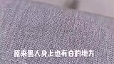 原来黑人身上也有白的地方