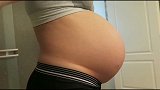 怀孕后脸部、身上长了许多“黑点点”，接男宝！