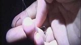 广东佛山：拉杆太猛鱼竿断裂，鱼钩“打中”围观男子右眼