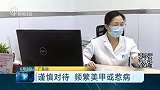 谨慎对待  频繁美甲或惹病