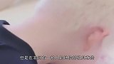 世界上最“贵”的人，血液比黄金还值钱，为了能活着提心吊胆