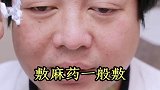 钟医生亲身示范打肉毒毒素！#皮肤管理 #肉毒毒素