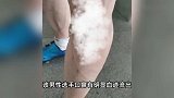 现场曝光！安徽一自行车赛选手被曝受伤进ICU陷昏迷，官方回应