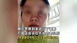 女子穿短裤引公公不满遭辱骂抓伤：老公不安慰，反而要求别那么穿