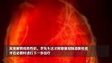 男子牙疼数日查出心梗！专家：这些都可能是心梗信号