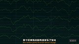对人类的睡眠模式你了解多少？快速眼动睡眠阶段如何支配大脑？