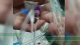 孩子医院打针时输液器内发现毛发 家长：有可能输到血液里