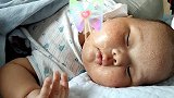 小宝宝睡觉睡得真香，只是这脸上的湿疹真引人注意，好萌啊！