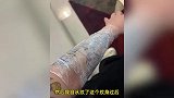 女子花3千纹花臂后悔又花万元洗掉：洗纹身后起水泡，被造谣染艾滋病