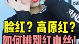 你脸上到底是不是红血丝 教你几个方法轻松分辨