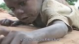非洲2岁小男孩，被认定“巫童”遗弃街头，如今模样让人心疼！