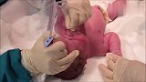 护士给呼吸受阻的新生儿吸出羊水,得救后的宝宝哭声都变得通透了