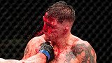 慎入！UFC最强嗜血之战 打完比赛双方已血肉模糊