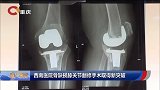 早新闻-20171130-西南医院骨缺损膝关节翻修手术取得新突破