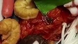 芝士部队火锅我的最爱