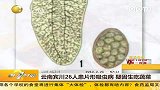 云南宾川26人患片形吸虫病疑因生吃蔬菜