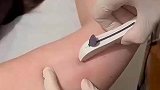 这是什么针，隔着屏幕都疼