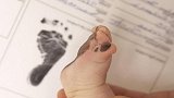为什么医院要留新生儿的脚印，而不是手印？医生告诉你答案