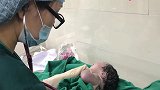 刚剖腹产出来的新生儿，哭声原来是这样的，与顺产宝宝差别明显