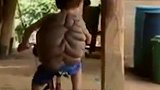 印度男童得“怪病”，背部长出乌龟壳，专家：“龟仙人”？
