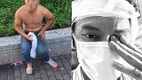 男子上海街头阻止性侵被咬掉耳朵 当事人：耳朵无法修复需要开颅
