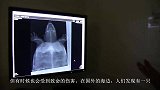 头和壳都被劈裂，被救治后海龟奇迹般恢复，还向医生点头感谢呢