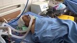 外墙掉脱落将68岁带孙老人砸趴 开颅手术取出长13厘米碎片