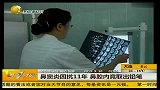 鼻窦炎困扰11年 鼻腔内竟取出铅笔