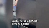 男子进山掏蘑菇，手指被毒蛇咬伤瞬间肿起：已住院3天手还在流脓