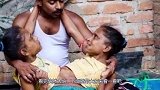 连体姐妹共用一个肚子，怀孕后生下的孩子算谁的？看完恍然大悟