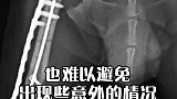 狗狗意外骨折救护方法！
