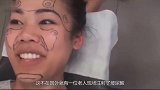 玻尿酸有多强大60岁老人现场注射，短短几分钟堪比换脸！