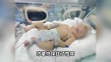 婴儿出生后颅骨骨折，家长质疑医生操作不当，医院：责任问题需等待鉴定