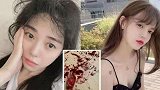韩女星再曝遭施暴辱骂！被异性看光割腕超20次