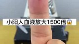 小阳人血液什么样，白色“小可爱”游动，就是白细胞处理致热因子