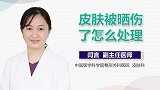 皮肤被晒伤了怎么处理？