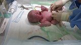 新生儿长啥样实拍处理台上刚出生的宝宝，很神奇的一幕！