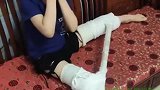 就因为被同学绊了一跤，结果就全打了石膏