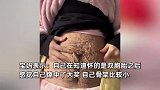 双胞胎宝妈晒产后28天肚子，皱巴巴满是“伟大的痕迹”：曾经也是身材曼妙的少女