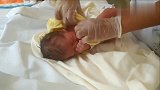 医生为刚出生的小宝宝穿衣服，这个视频有点魔性，你能发现吗