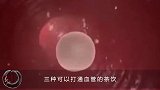 清除毒素要多吃的3种食物血管越吃越健康