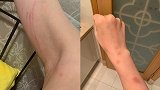 张培萌妻子称被家暴 对方自辩：运动员都这样 雄性激素高
