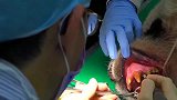 熊猫吃竹子把牙崩坏了, 医生为其安换上新牙, 厉害了我的国宝