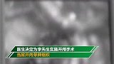 男子生吞蛇胆 20年后医生开颅时被眼前一幕惊呆