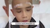 知名网红剃光头发动手术，自曝因病暴瘦掉粉千万，赔了2000万违约金